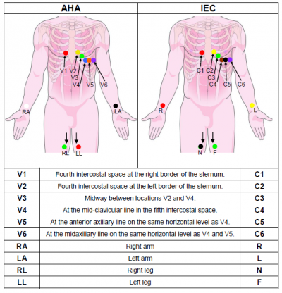 Electrocardiography - Wikipedia